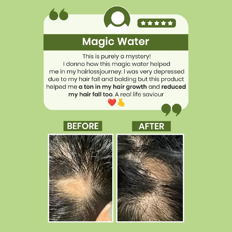 Alps Goodness Rosemary Water for Hair Regrowth - Image 3