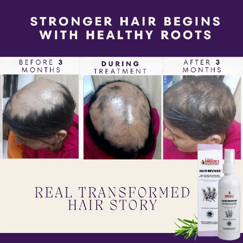 Bakson's Homeopathy Hair Reviver - Image 4