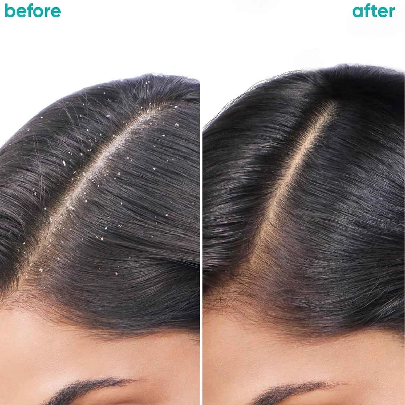 Biolage Professional Scalppure Anti-Dandruff Shampoo - Image 2