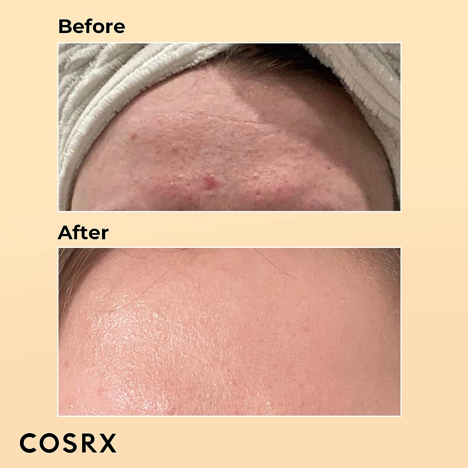 COSRX Snail Mucin 96% Power Repairing Essence 3.38 fl.oz - Image 4