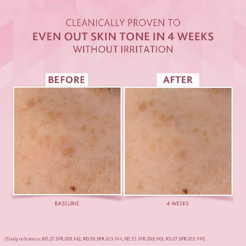 Cetaphil Brightening Day Cream with Niacinamide reduces Dark spots - Image 6