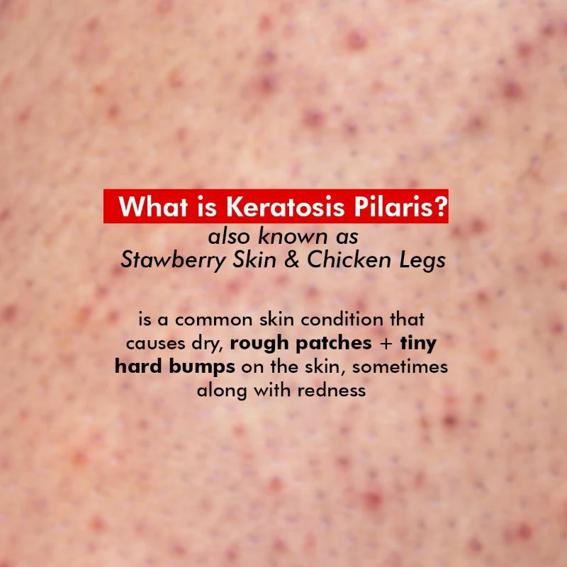 Conscious Chemist Body Exfoliating & Pigmentation Removal - Image 7