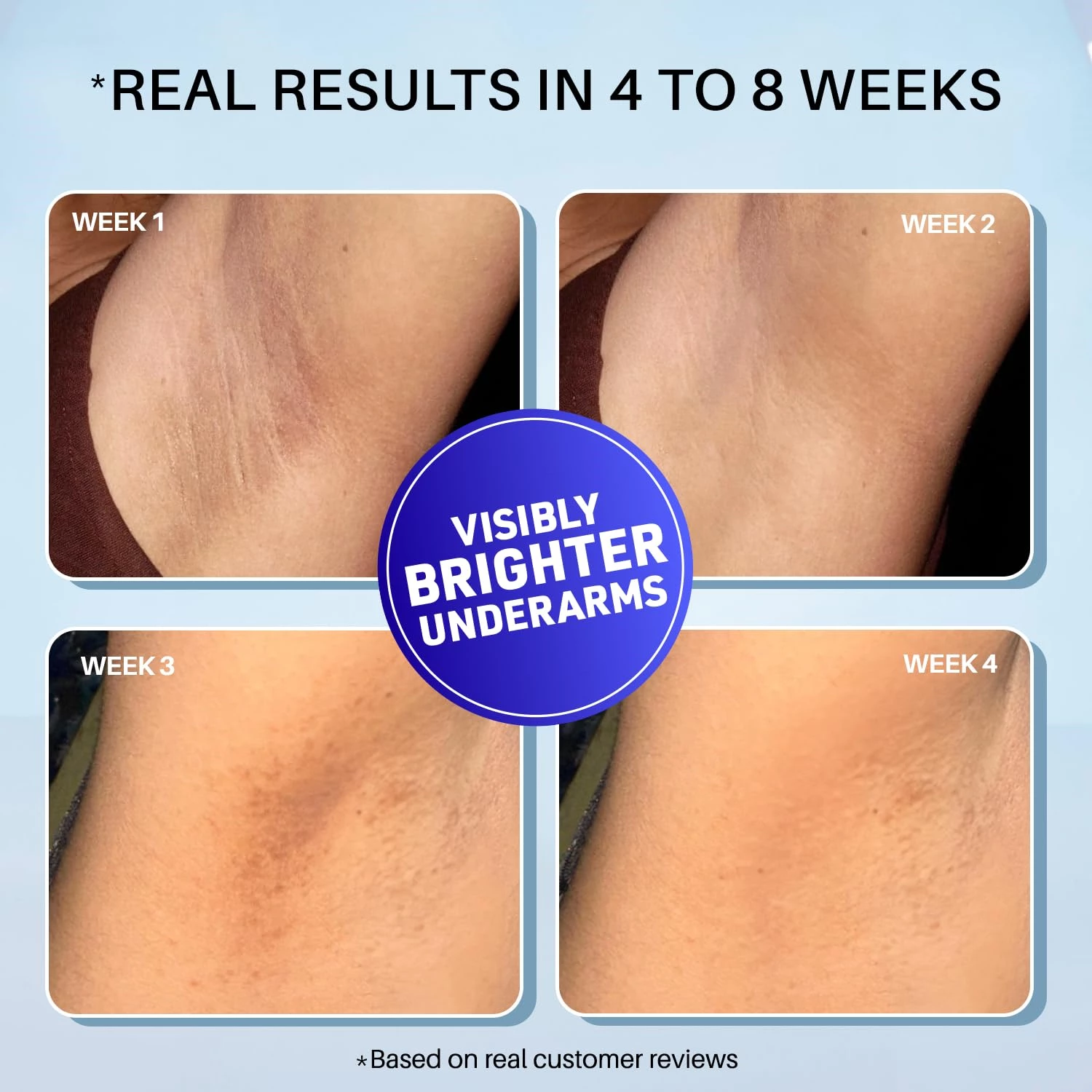 Dermdoc 5% Glycolic Acid Underarm Brightening Spray Treatment - Image 2