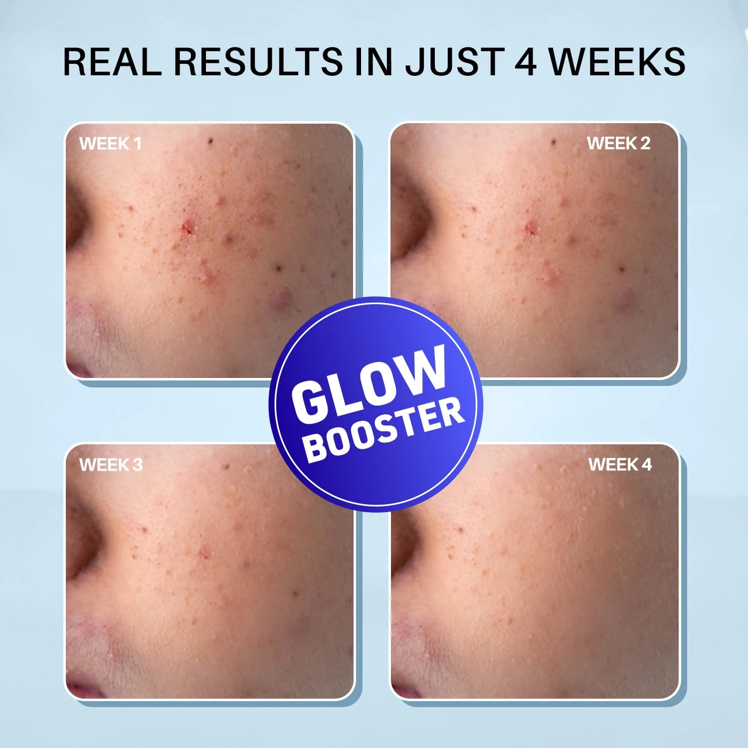 Dermdoc 2% Kojic Acid Night Cream - Image 2