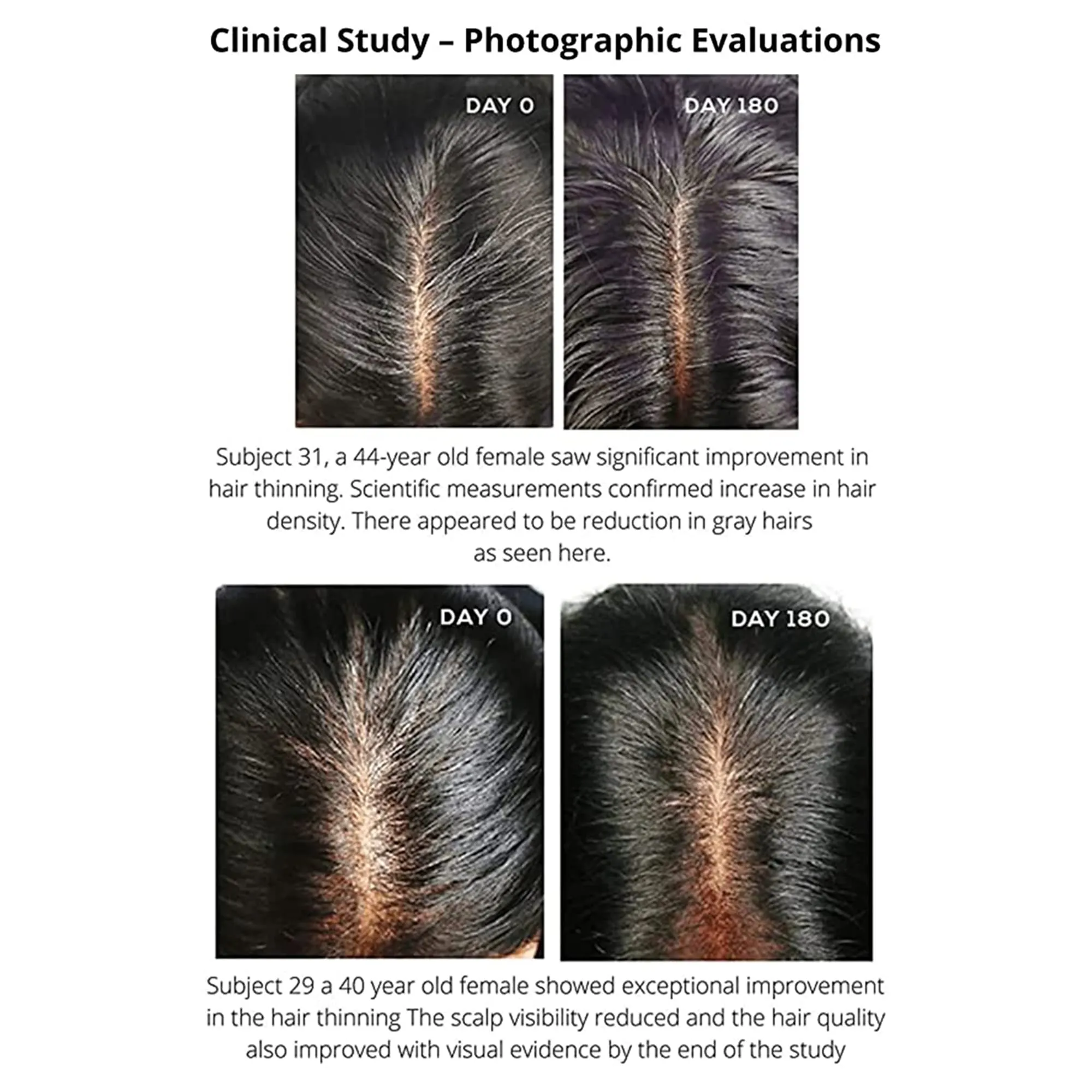 Diabliss Herbal Water For Healthy Hair - Image 4
