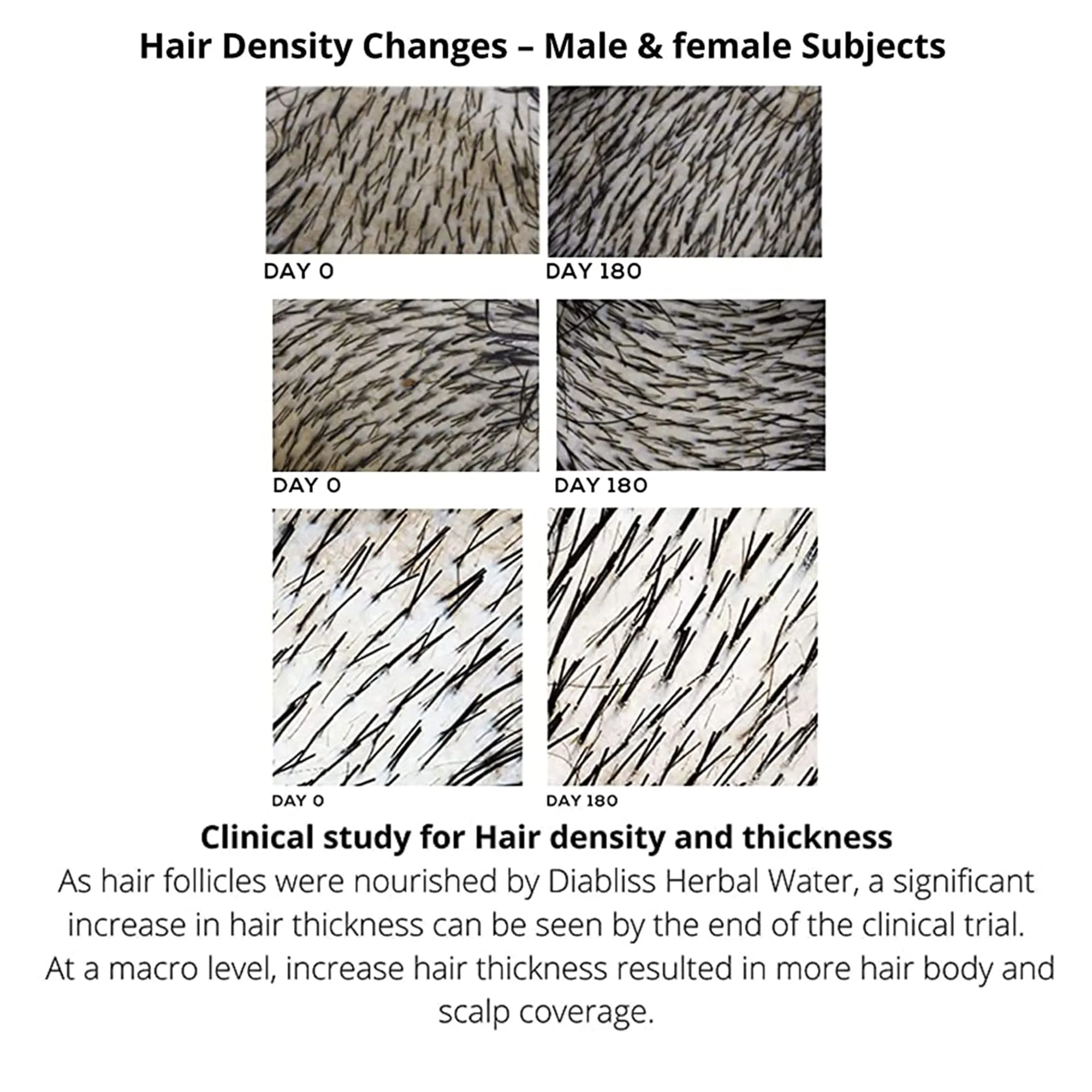 Diabliss Herbal Water For Healthy Hair - Image 5