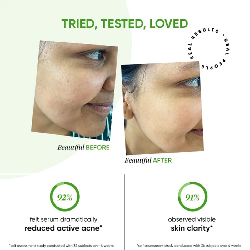Dot & Key 2% Salicylic Acid + Cica Anti Acne Serum with Zinc - Image 6
