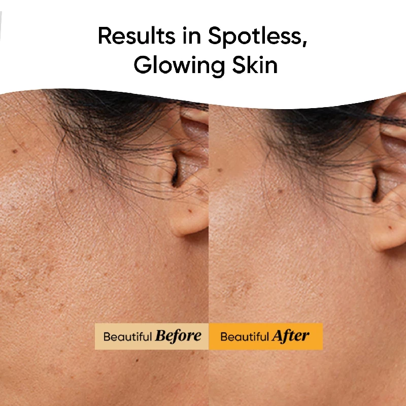 Dot & Key Glow Revealing Vitamin C Serum Concentrate with Kakadu Plum & Acerola Cherry - Image 3