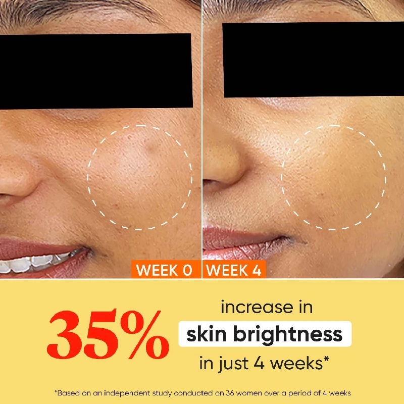 Dot & Key Vitamin C + E Sorbet Super Bright Moisturizer for Face - Image 3