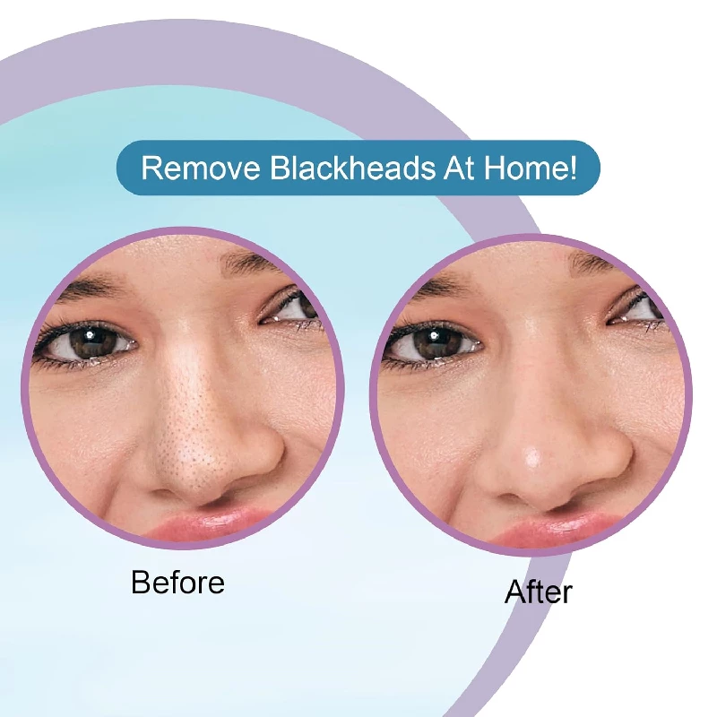 Dr.Rashel Hyaluronic Nose Pore Strips For Pore Cleansing - Image 2
