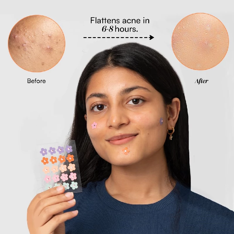 Gush Acne Pimple Patches-Flower - Image 2
