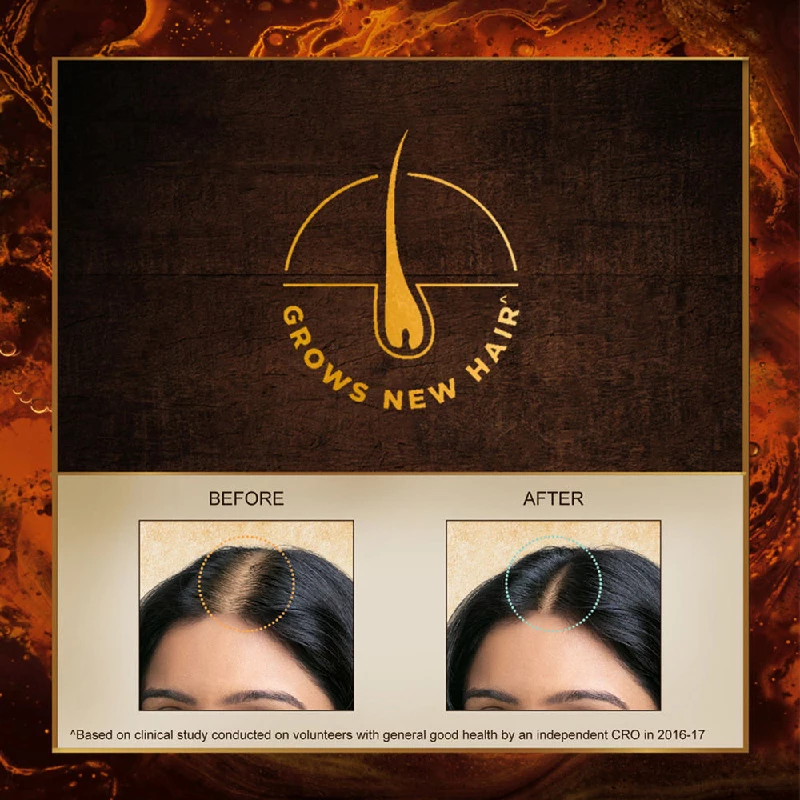Indulekha Bringha Hair Oil - Image 4