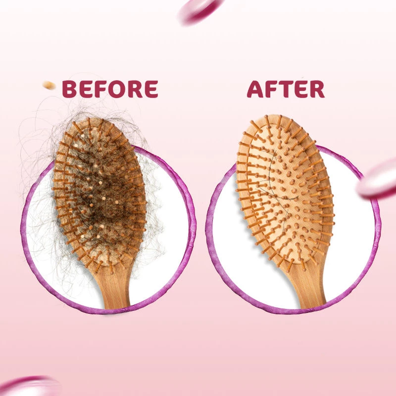 Mamaearth Onion Anti Hair Fall Spa Range with Shampoo + Conditioner + Oil for Hair Fall Control - Image 5