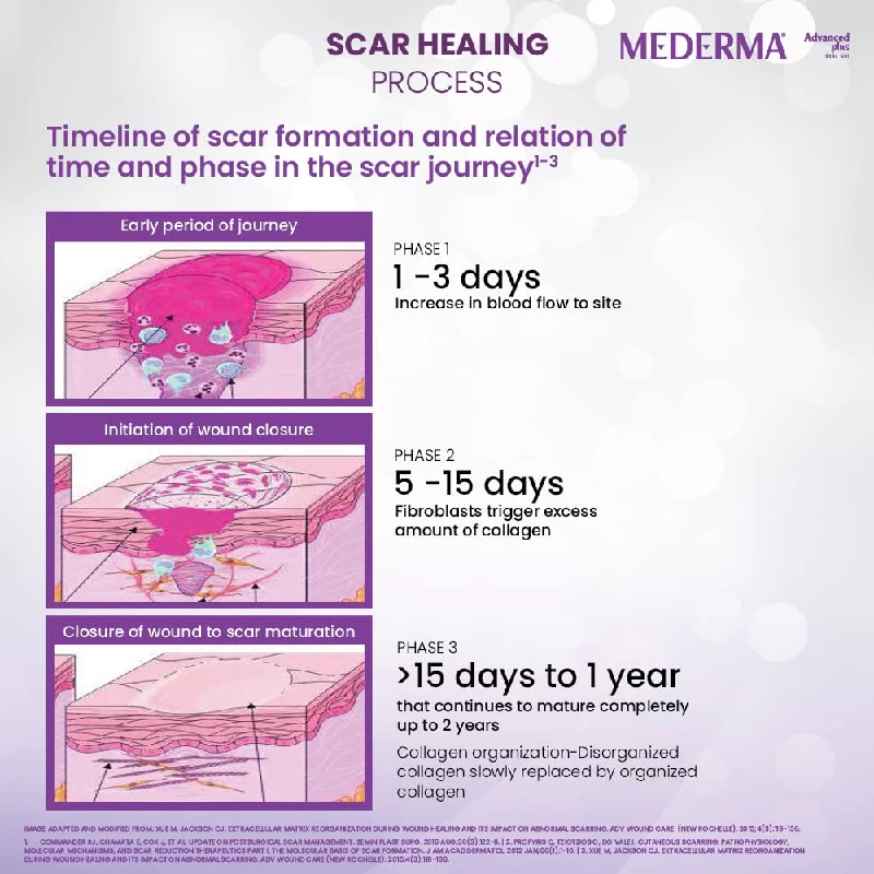 Mederma Advance Plus Scar Gel - Image 3