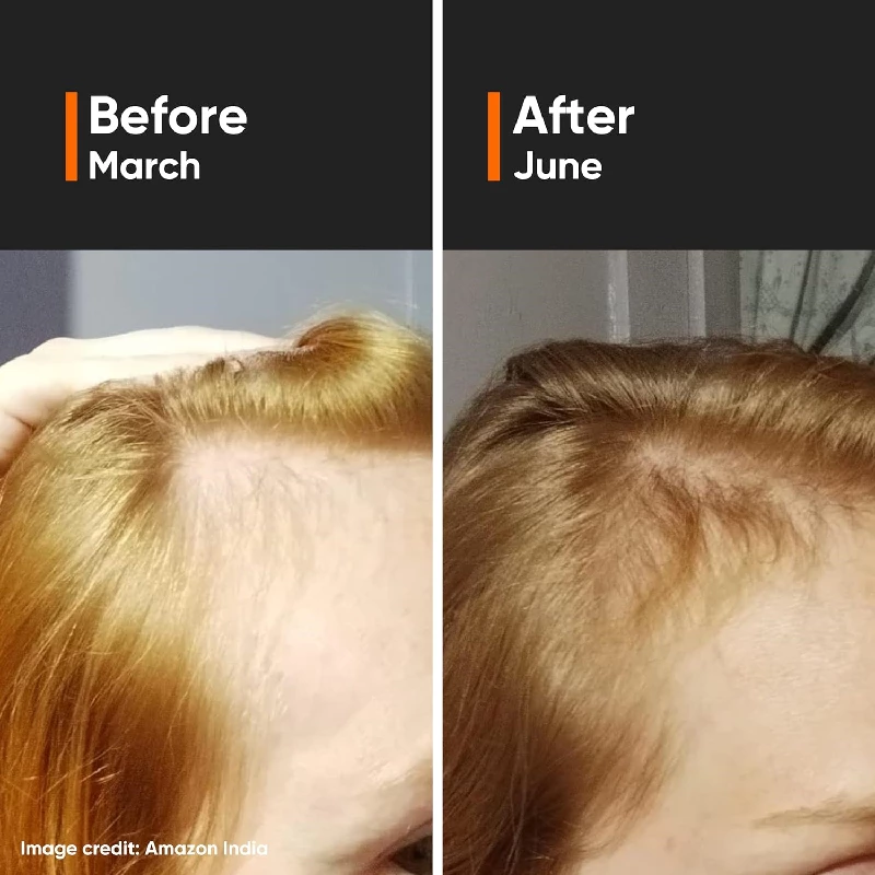 Minimalist Hair Growth Serum - Image 3