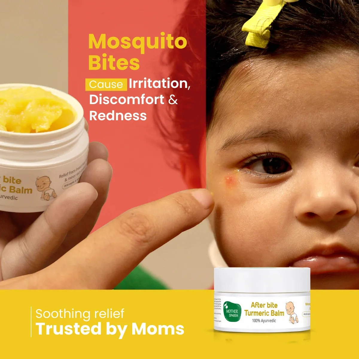 Mother Sparsh After Bite Turmeric Balm for Mosquito & Insect Relief - Image 2