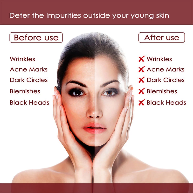 NutriGlow Wine Facial Kit For Blemish Free Fairer Complexion - Image 4