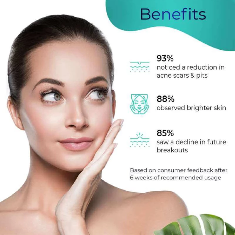 Pilgrim Niacinamide & Alpha Arbutin Skin Clarifying Serum for acne & acne marks - Image 3