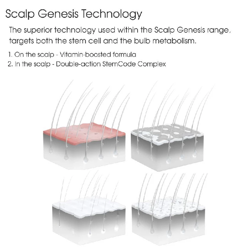 Schwarzkopf Professional Bonacure Scalp Genesis Anti Dandruff Shampoo - Image 3