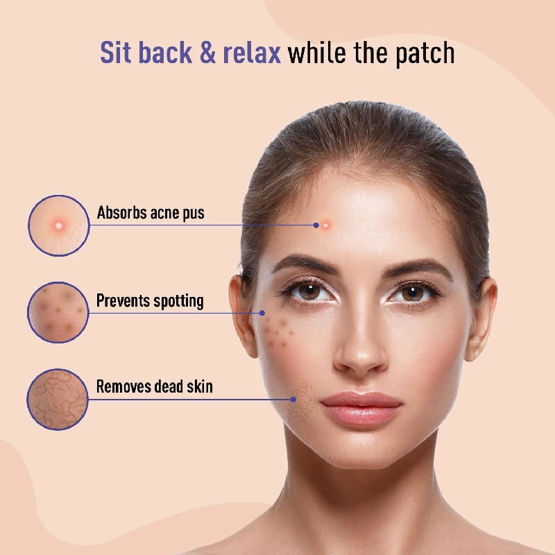 Sirona Anti Acne Pimple Patches for Face - Image 2