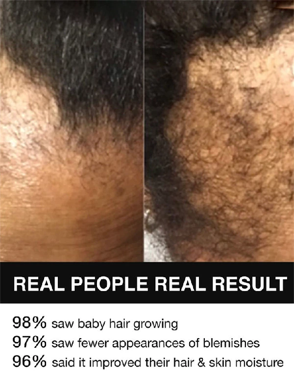 Soulflower Organic Rosemary Hair Growth Essential Oil - Image 8