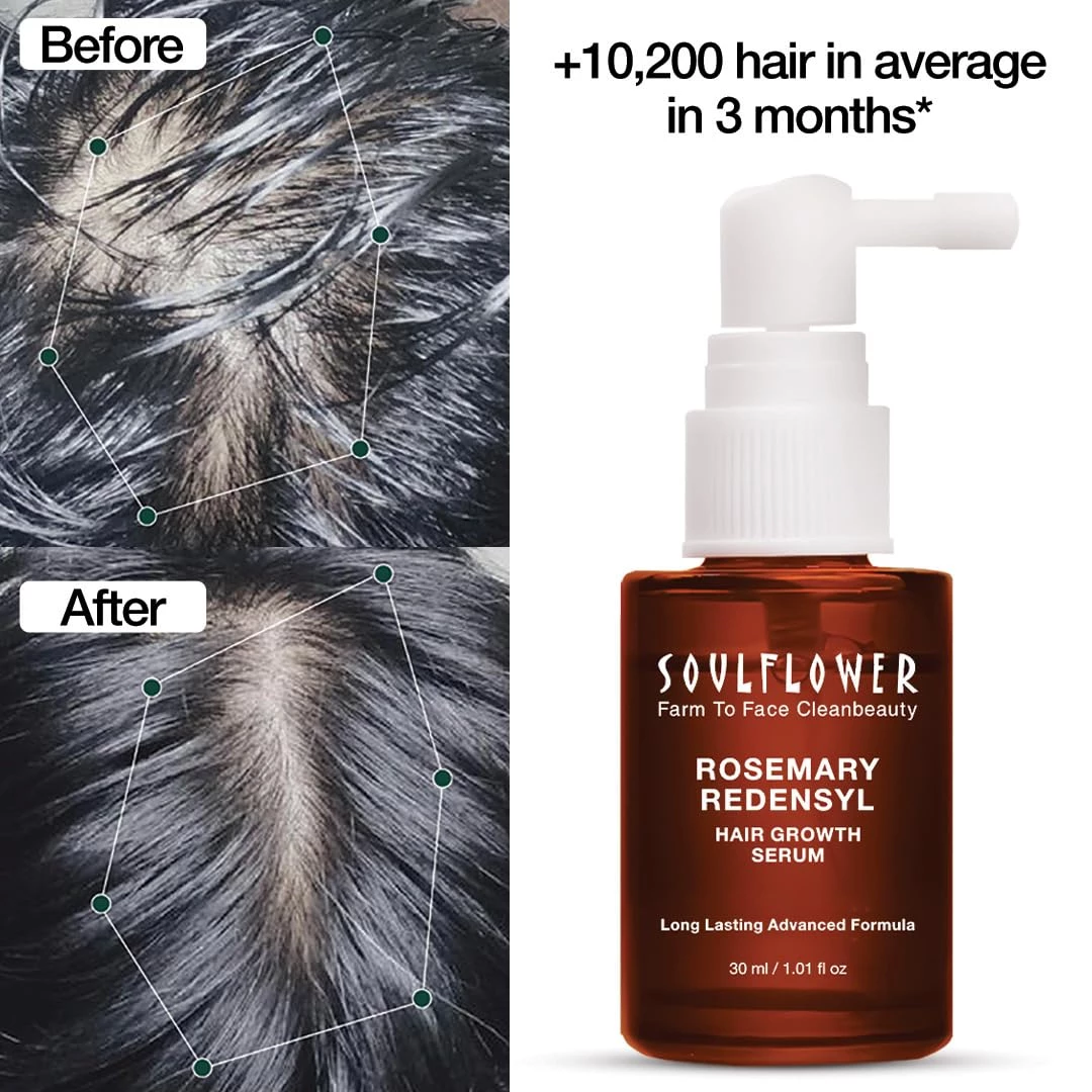 Soulflower Rosemary Redensyl Hair Growth Serum - Image 2