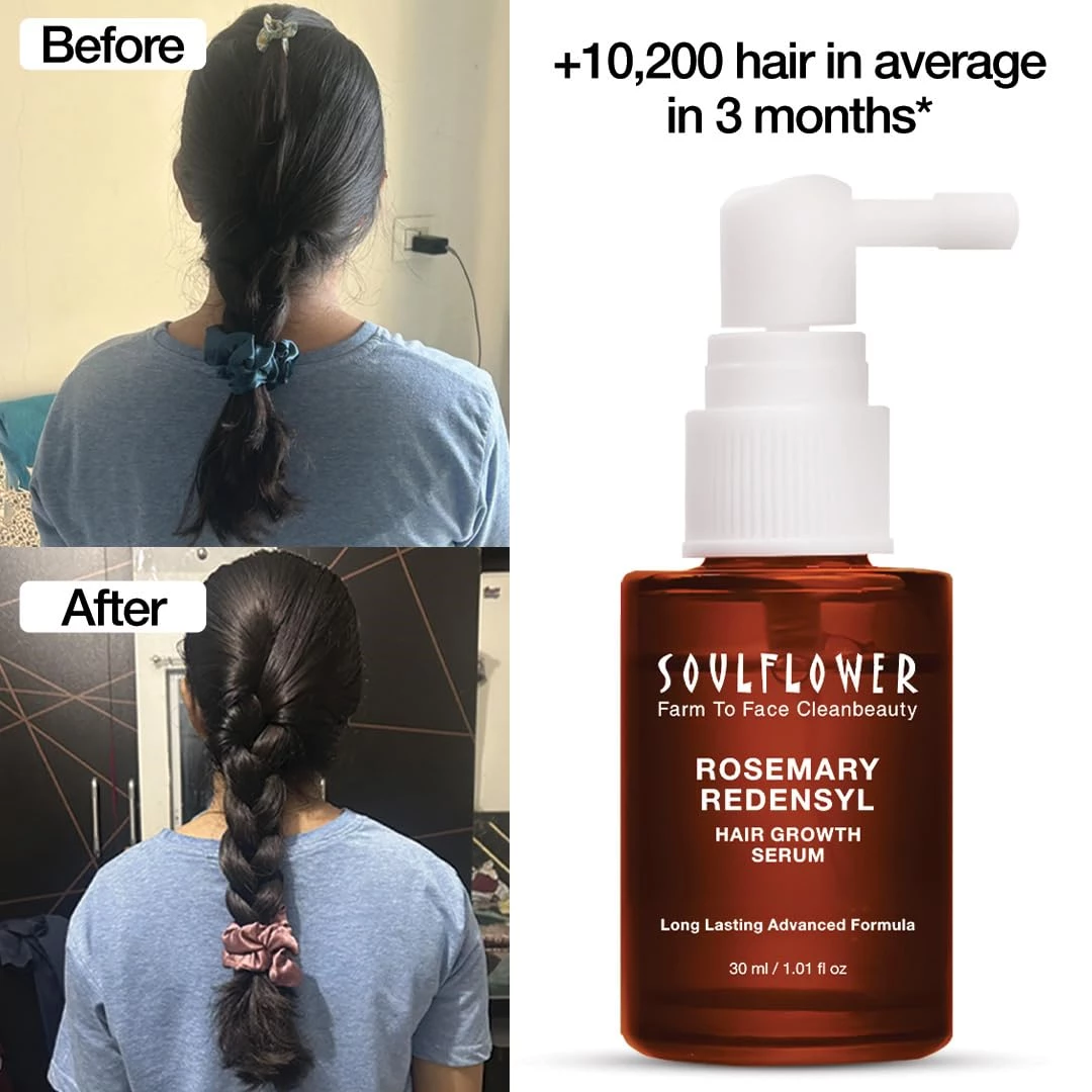 Soulflower Rosemary Redensyl Hair Growth Serum - Image 3