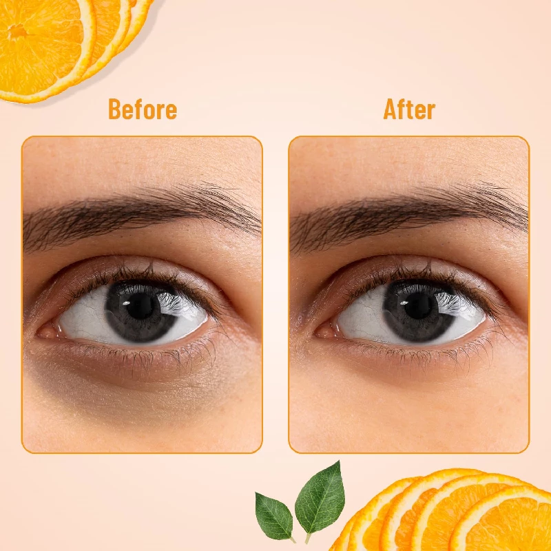 Swiss Beauty Hydra Anti Wrinkle Eye Serum Patch - Image 15