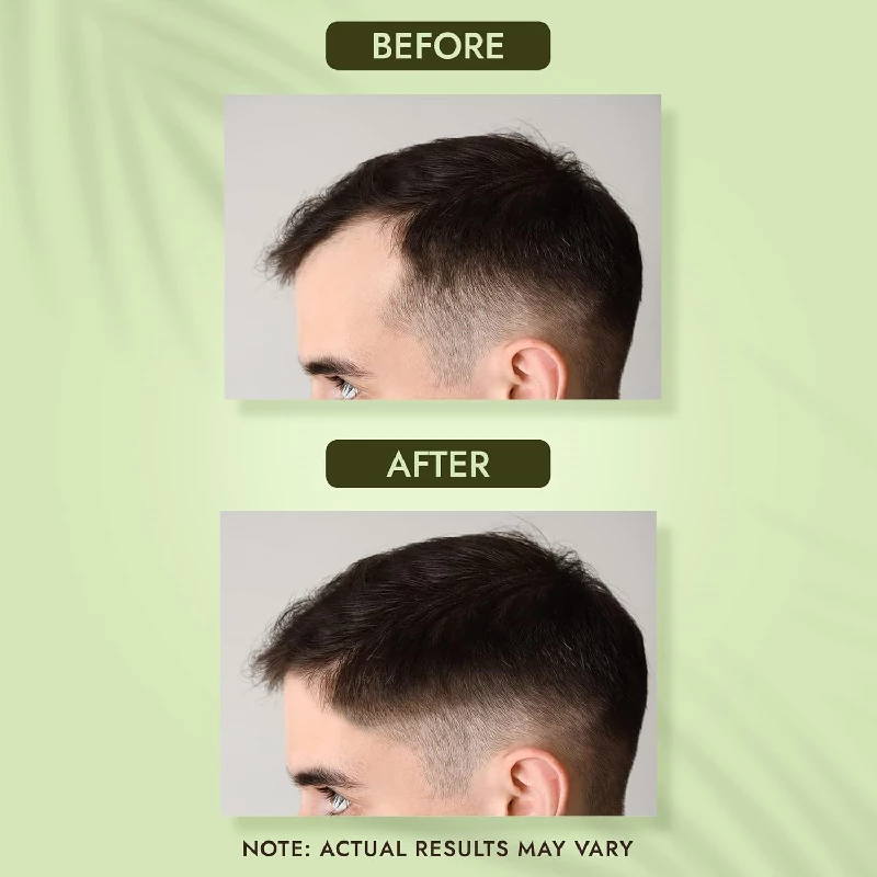 Trichup Healthy Long & Strong Hair Shampoo - Image 4