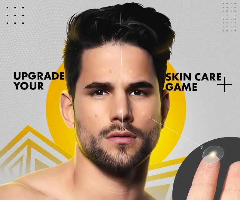 UrbanGabru Acne Pimple Patch - Image 2