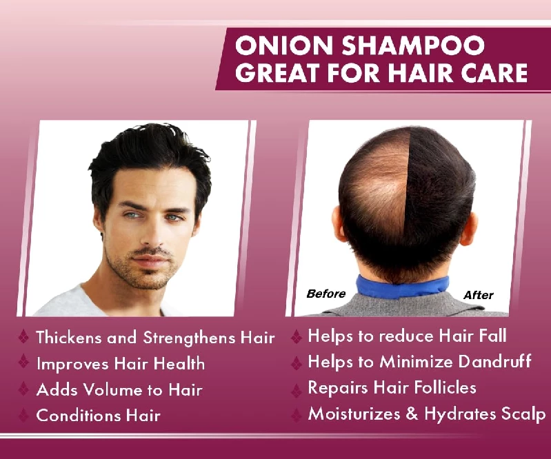 UrbanGabru Natural Onion shampoo - Image 6