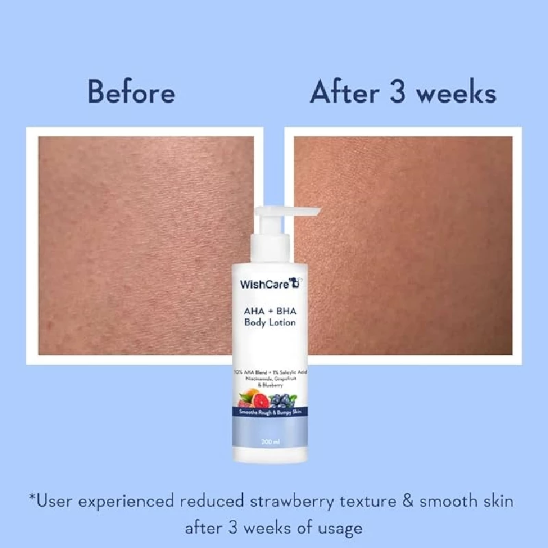 WishCare 10% AHA + 1% BHA Body Lotion - Image 2
