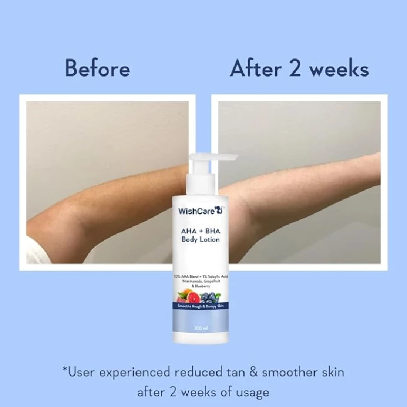 WishCare 10% AHA + 1% BHA Body Lotion - Image 3