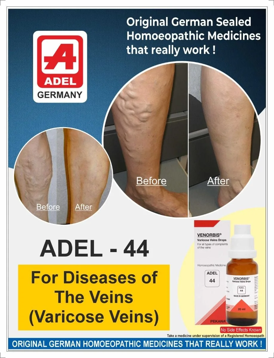 Adel Homeopathy 44 Drops | Venorbis Homeopathic Remedy | Venous Circulation and Leg Discomfort Support-2