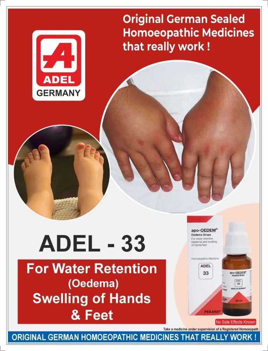 Adel Homeopathy 33 Apo-Oedem Drop | Homeopathic Fluid Balance Formula | Natural Support for Water Retention and Swelling-2