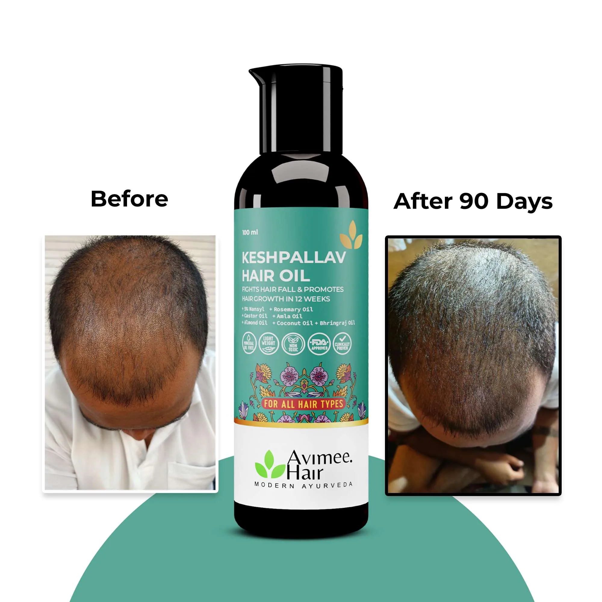 Avimee Herbal Hair Growth Kit | Complete 3-Step Ayurvedic Hair Care Routine | Keshpallav Oil, Shakuntala Cleanser & Scalptone Serum-4
