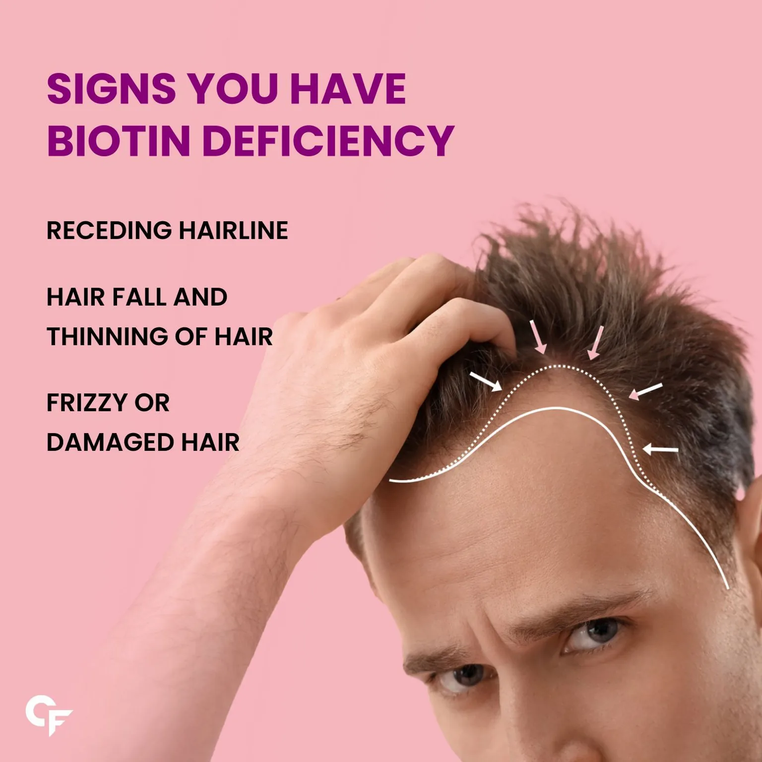 Carbamide Forte Biotin 10000mcg Tablets | High Potency Hair Growth Supplement | Vegetarian Unflavored Formula-6