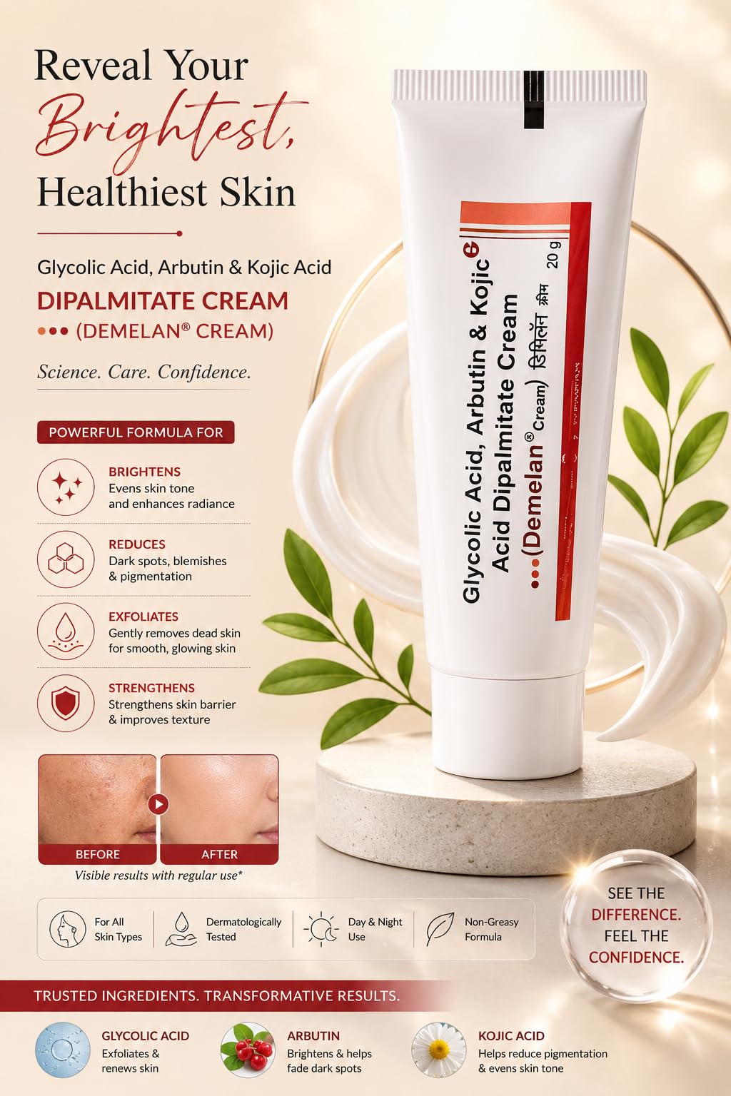 Demelan Cream For Pigmentation & Marks | Hyperpigmentation Treatment | Promotes Even Skin Tone-2