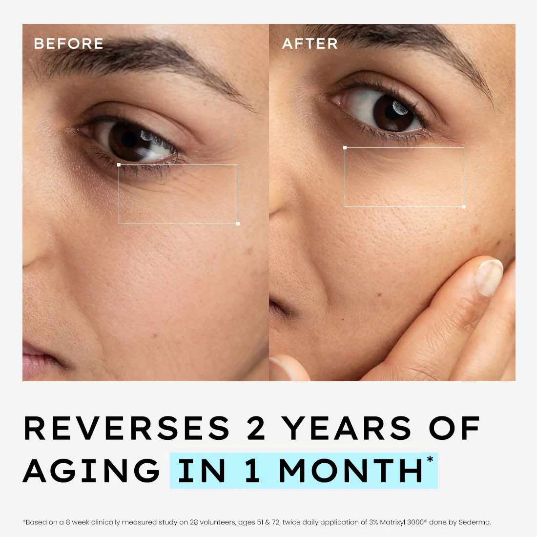 Hyphen 10% Power Peptide Cocktail Serum | Multi-Peptide Face Serum | Firming and Plumping Formula-5