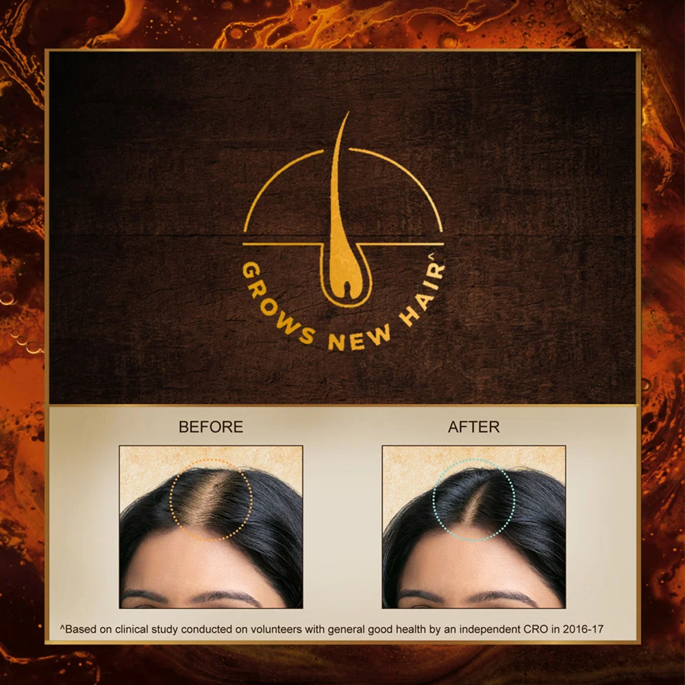 Indulekha Bhringa Hair Oil | Ayurvedic Medicine for Hair Fall Control | Selfie Bottle Applicator-2
