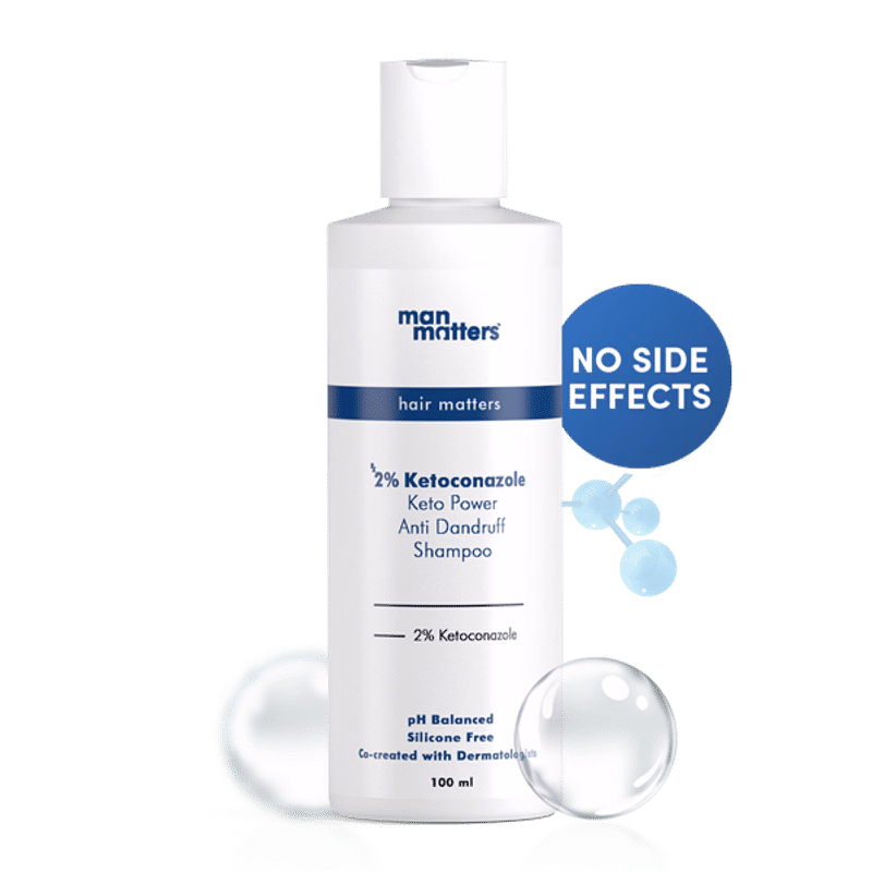 Man Matters 2% Ketoconazole Anti Dandruff Shampoo | Vegan Scalp Care | Fights Flakes and Itching-2