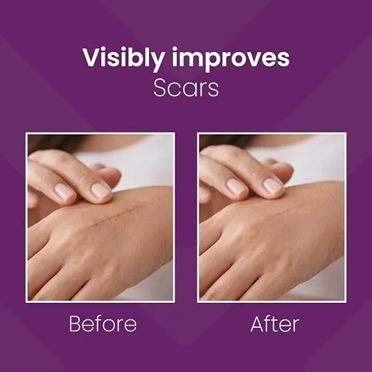 Mederma Advanced Plus Scar Gel | Skin Regenerating Formula | Smooths and Fades Old and New Scars-2