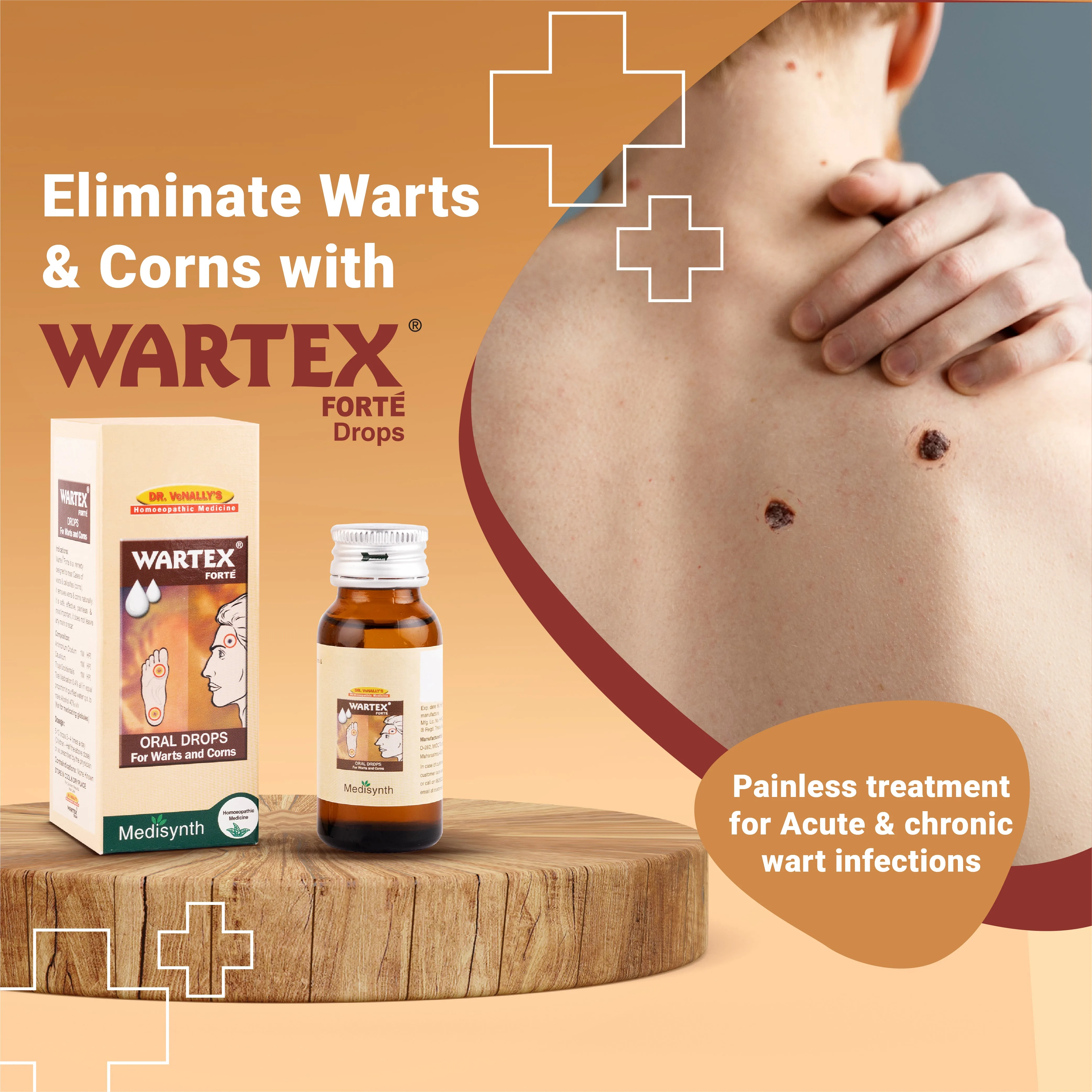 Medisynth Wartex Forte Drops | Homeopathic Remedy | Painless Care for Warts and Corns-2