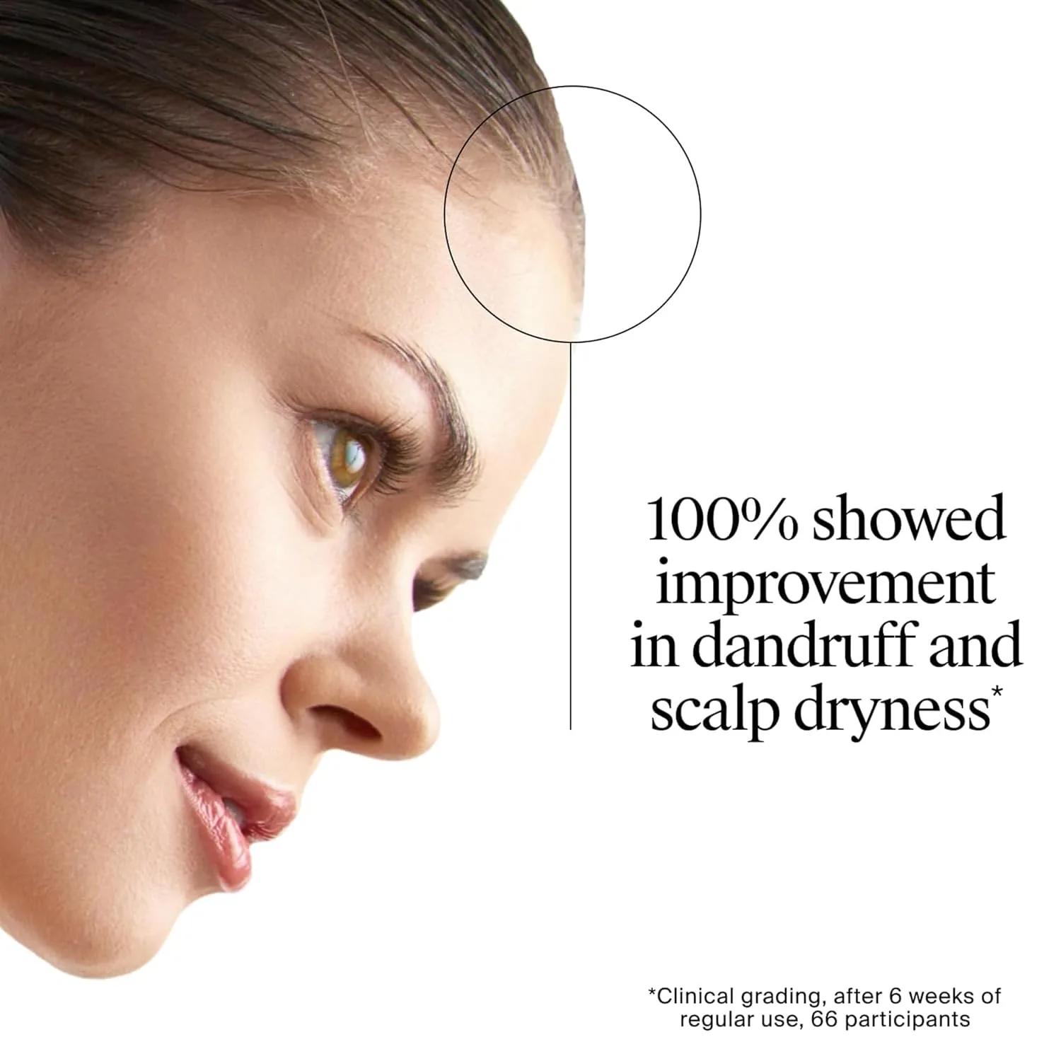 Neutrogena T/Gel Therapeutic Shampoo | Anti-Dandruff Scalp Treatment | Itch and Flake Relief-5