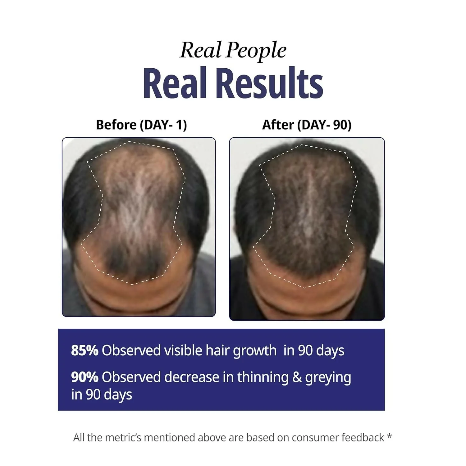 Reginald Men Athena All in One Hair Serum | Hair Growth & Fall Control Serum | Rice Water & Redensyl Formula-5