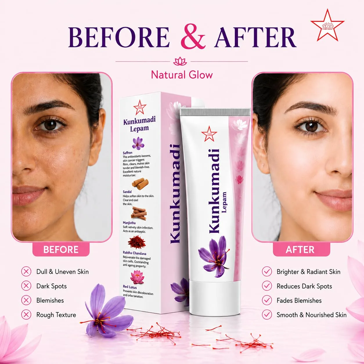 Skm Ayurveda Kumkumadi Lepam | Ayurvedic Face Cream | Radiant Skin & Blemish Care-3