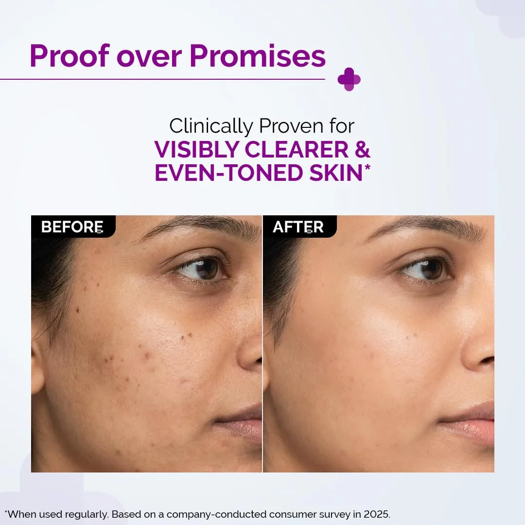 The Derma Co 10% Niacinamide Face Serum | Clarifying Skin Treatment | Fades Acne Marks & Controls Sebum-4