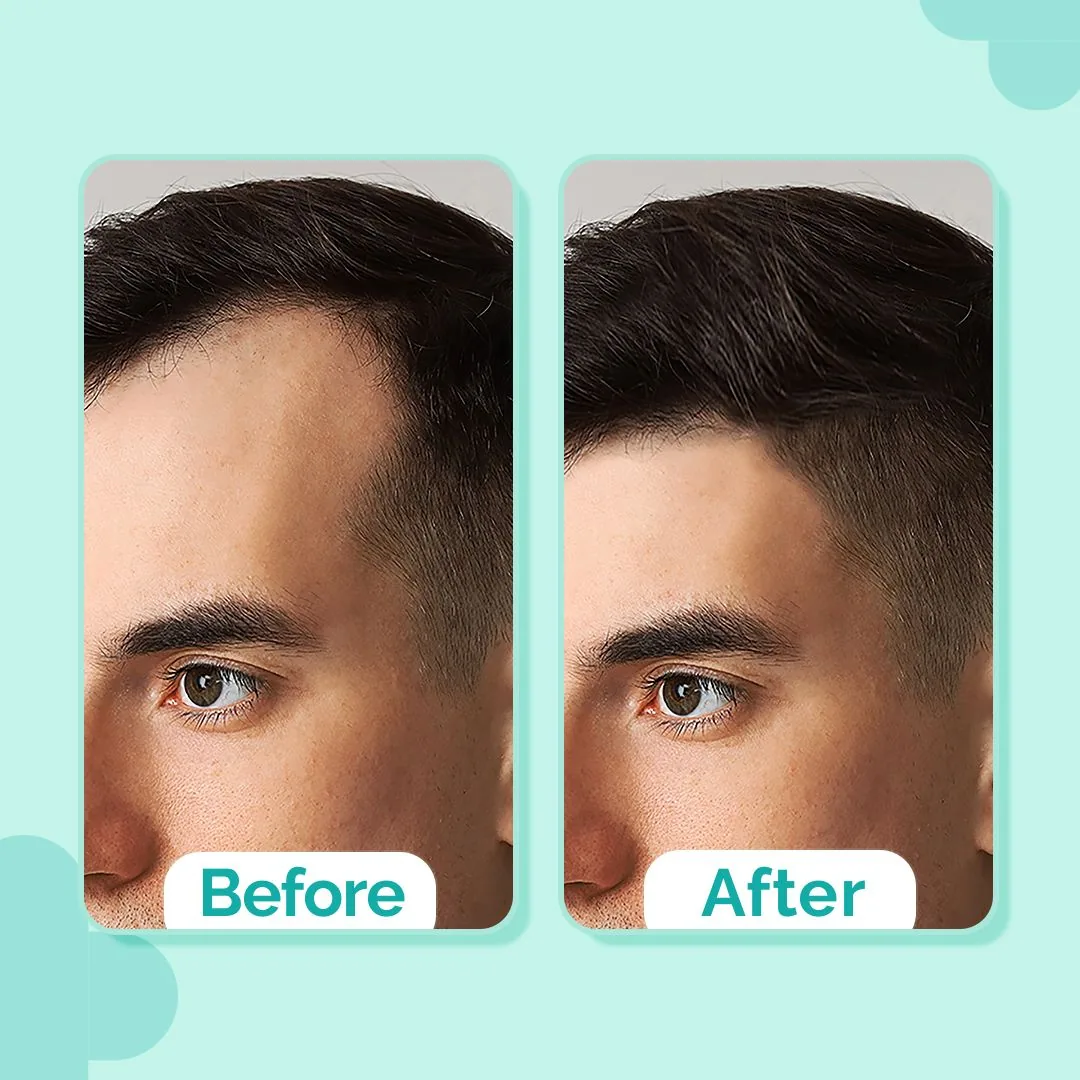 The Derma Co 20% Actives Peptide Stem Cell Hair Growth Serum | Advanced Scalp Therapy | For Thicker and Stronger Hair-4