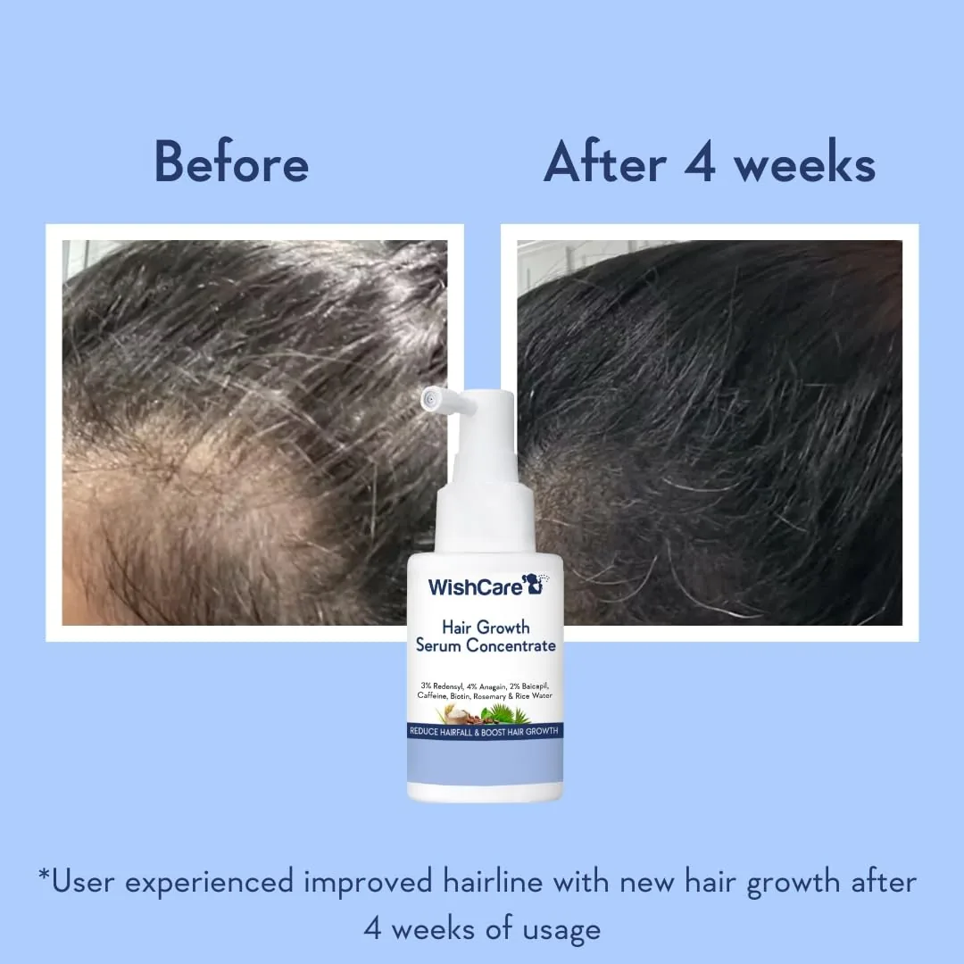 Wishcare Hair Growth Serum Concentrate and Multi Peptide Anti Hairfall Shampoo Combo | Hair Strengthening Duo | Redensyl & Rice Water Formula-3